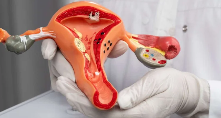 Can Fibroids Be Treated Without Surgery?